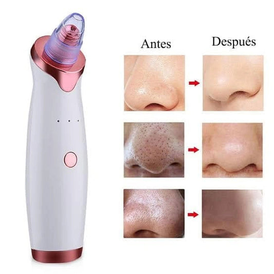 PoreClean Pro® – Miles en Colombia ya lo usan para decirle adiós a los puntos negros y espinillas 😱💨